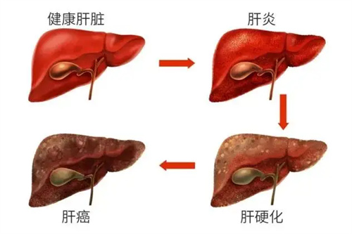 细节说明