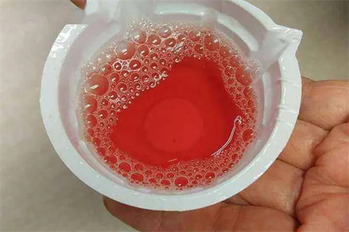详细说明