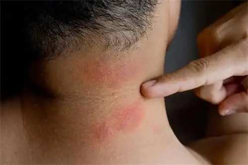 细节介绍